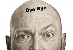 cause della calvizie